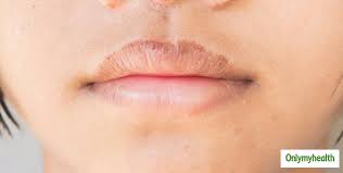 are lip changes during pregnancy real
