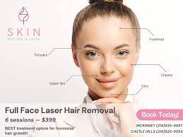 laser hair removal mckinney tx skin