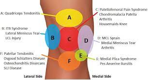 knee pain diagnosis chart knee pain