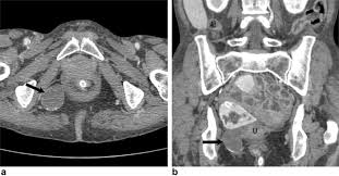 female with chronic abdominal pain