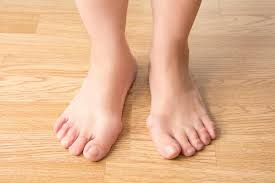 how bunions affect your overall health