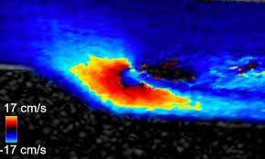 in ultrasound color doppler imaging