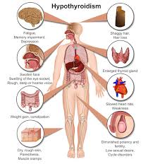 thyroid disease 20 symptoms the