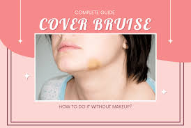 how to cover a bruise without makeup