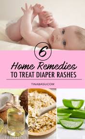home remes to treat diaper rash