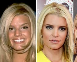 Imagen de Jessica Simpson before and after plastic surgery