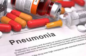 Ketahui Obat Pneumonia Sesuai Penyebabnya - Alodokter