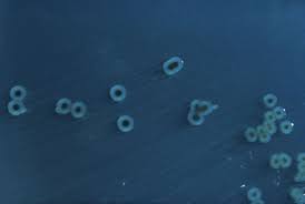 Salmonella Typhimurium – Wikipedia
