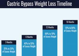 4 weeks after gastric sleeve surgery