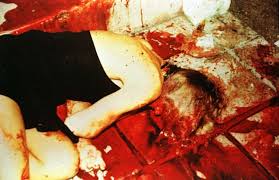 O.J. Simpson Murder Trial: Bloody Crime Scene Photos!