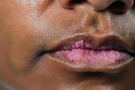 a close up of a womans lips with pink spots