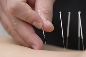 Which Needle Cpd Health Courses Dry Needling Training