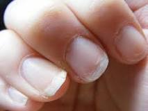 are-gel-nails-toxic