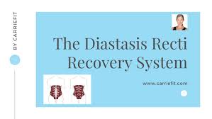 diastasis recti recovery system udemy