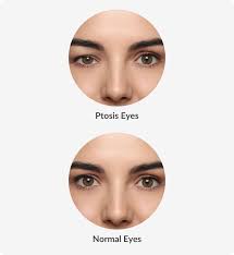 eye shapes optical centre vision
