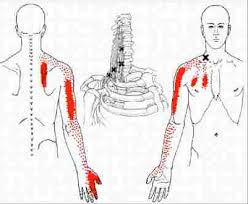 myofascial trigger point therapy