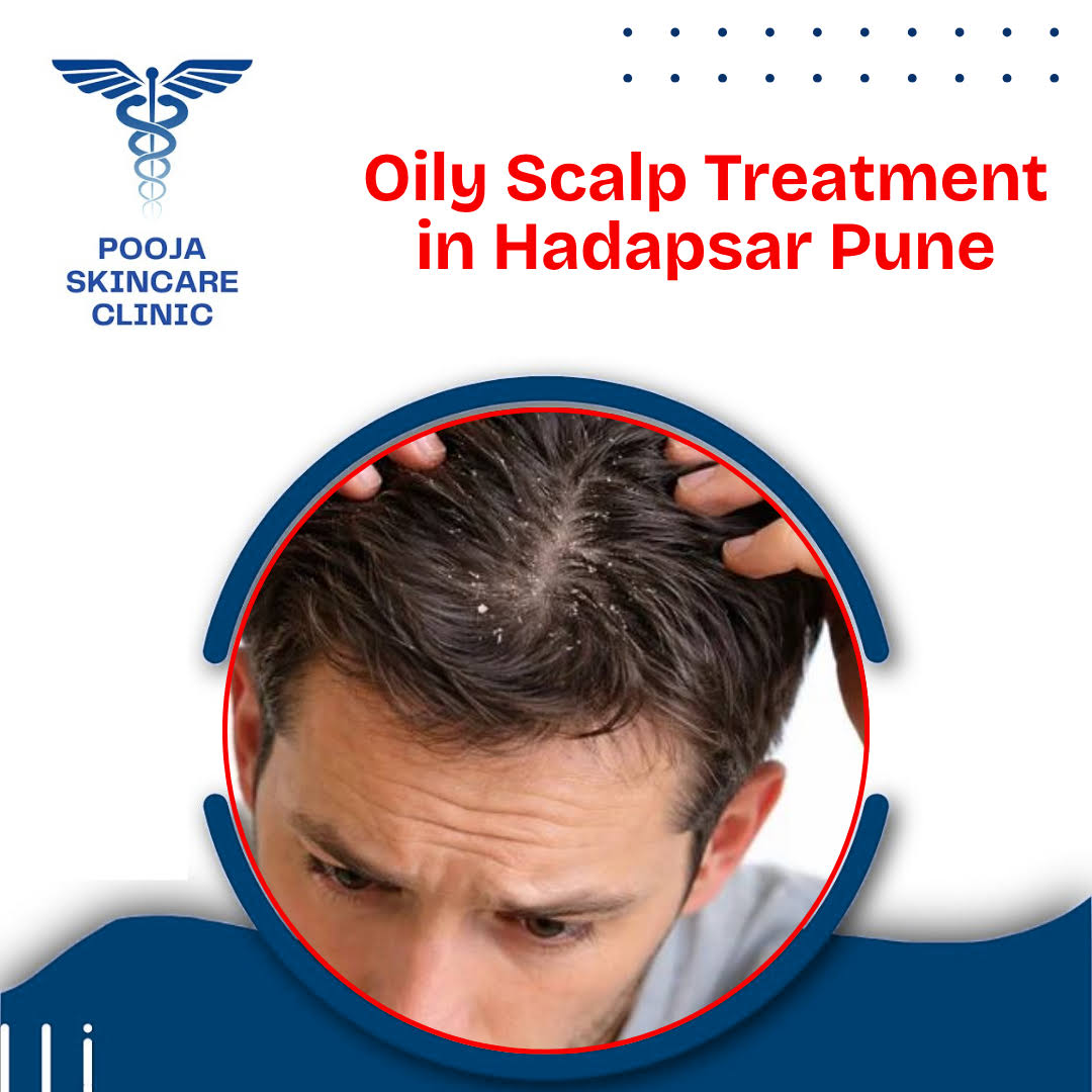 Oily Scalp Treatment in Hadapsar Pune product image