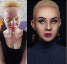 transformation of an albino woman