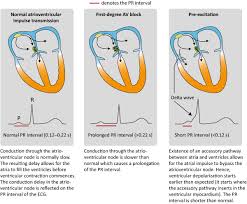 Ecg Interpretation Characteristics Of The Normal Ecg P