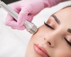 microdermabrasion williamsville ny