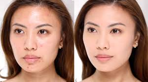 how to cover acne no foundation makeup