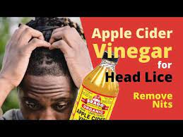 apple cider vinegar for lice how to