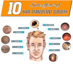 Grab your hair, get your hands ready, and you'll be set for a weave that will make all. 10 Side Effects Of Hair Transplant Surgery Ak Clinics