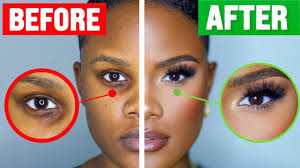 how to cover dark under eye circles