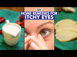 home remes for itchy eyes diy fit