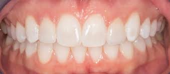 teeth whitening cosmetic dentist in