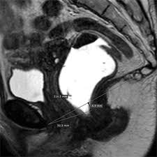 dynamic mr imaging of pelvic floor