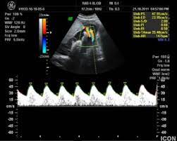 ultrasound examination 28 34 weeks and