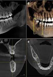 cbct dental imaging in oakville at