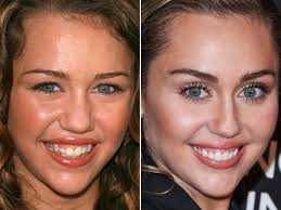 miley cyrus before and after the