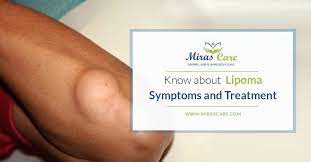 what is lipomas causes symptoms