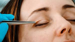 how to fix the impending eyelids