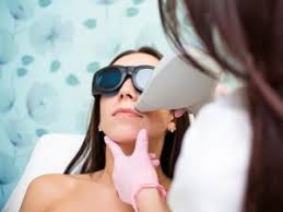 face laser hair removal cost
