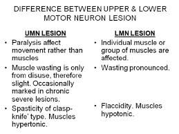 lower neuron disease