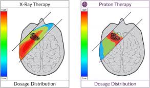 proton therapy treatment precise