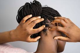 what causes tingling scalp