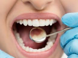 It is normal t o feel tingling and maybe even some twitching as the local anaesthetic wears off. Tooth Sensitivity After A Filling What Is Normal