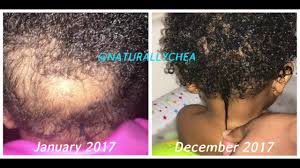 It's very hard for me to find products that'll actually hydrate my hair and keep it shiny even for more than a day (seriously!). Natural Hair Journey Baby Toddler Natural Hair Care Tips L Baby Bald Spot Youtube