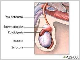 For stage 1 patients, this may be all that is needed to remove the cancer. Testicular Cancer