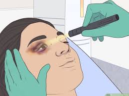 how to cover a black eye 9 steps with