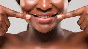 lip augmentation concept young african