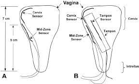 Tampons are used internally and once inserted, the vaginal walls hold the tampon in place. Placement Of Vaginal Sensors In Vaginal Canal Pre A And Post B Download Scientific Diagram