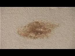 carpet cleaning how to remove soda