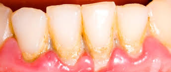 holistic periodontology mondcentrum