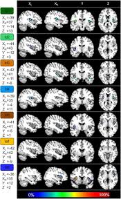 seven new areas in the insular cortex