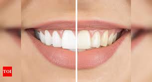 ayurvedic teeth whitening powder